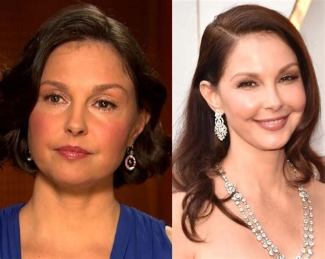 ashley judd plastic surgery|Ashley Judd Plastic Surgery: Rumors and Analysis ...